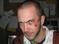 Reverend after a sparring session with Uro.., Rev dented after a rather nasty headbutt from the pavemet.. eerr.. Uro..